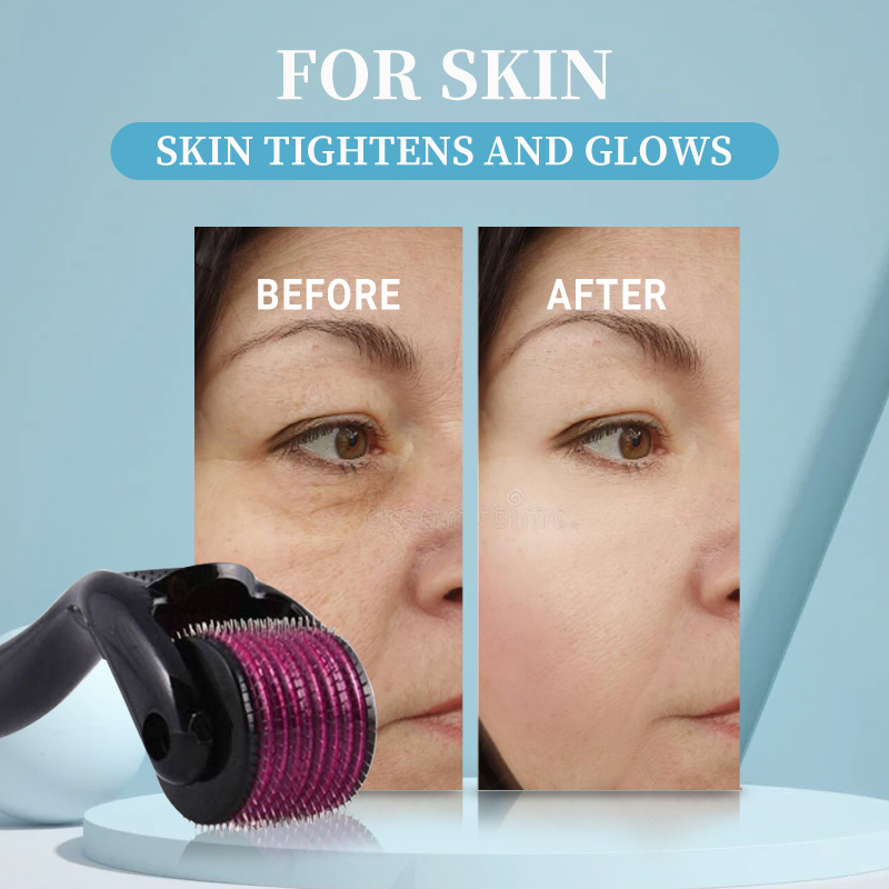 Professional 540 Roller Derma  - Derma Roller 0.25 recension och pris